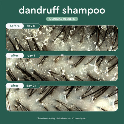 Dandruff Shampoo