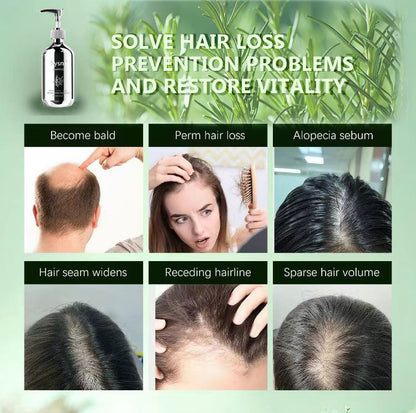 Sysni Organic Rosemary Shampoo and Tea Tree Special Shampoo, Keratin Nourishing Shampoo ,Promote Hair Growth, Strengthening Shampoo, Prevent Hair Loss Cleansing Shampoo,Deep Cleans, Refreshes Scalp, F